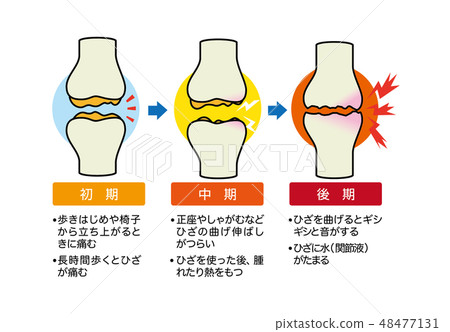 joint 48477131