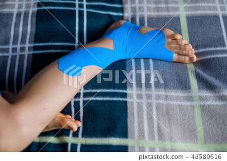 Elastic therapeutic tape applied to patient leg. Elastic therapeutic tape applied to patient leg. 48580616
