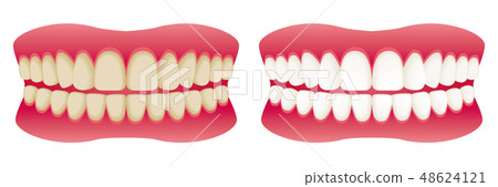 Teeth whitening before after ad illustration 48624121