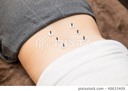 艾灸的女人 48633409