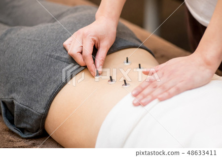 艾灸的女人 48633411