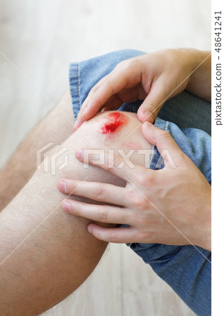 Broken bleeding knee  48641241