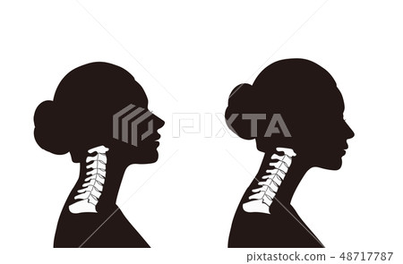 頸部骨架圖比較 頸部骨架圖比較 48717787