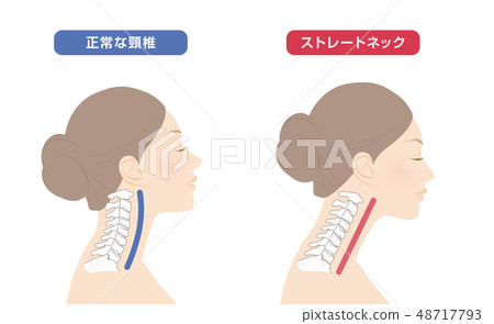 Comparison of neck skeleton diagram 48717793