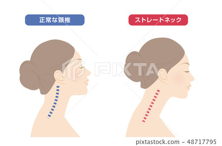 Comparison of neck skeleton diagram 48717795