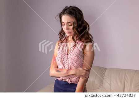 People, violence and abuse concept - Woman victim suffering from abuse, harassment People, violence and abuse concept - Woman victim suffering from abuse, harassment 48724827