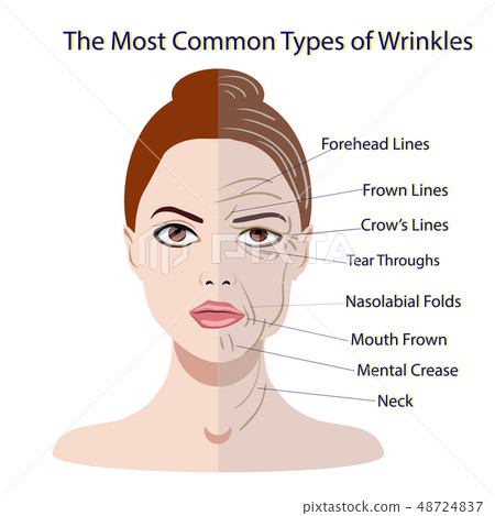 Common Types of Facial Wrinkles. cosmetic surgery. 48724837