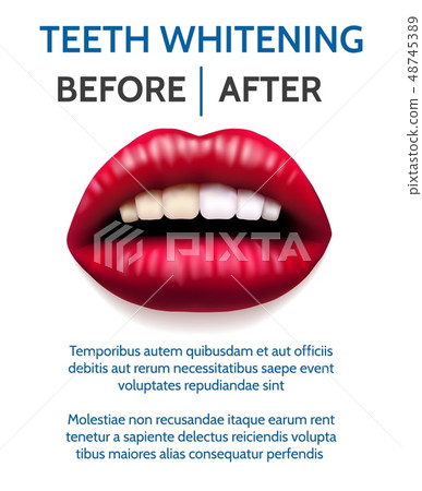 Teeth whitening poster Teeth whitening poster 48745389