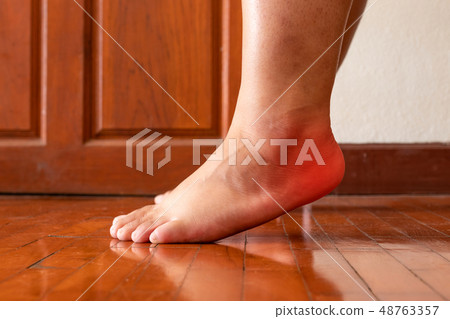 Female foot heel pain or plantar fasciitis. Health 48763357