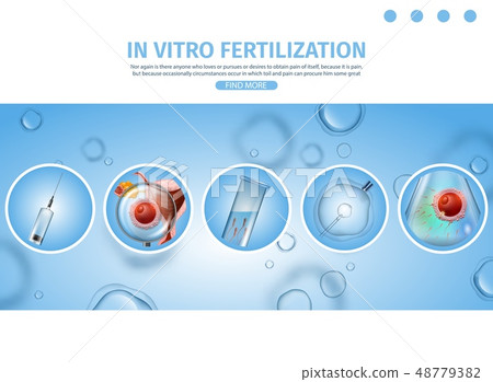IVF Process Procedures Schematic Explanations. 48779382