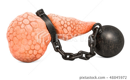 Pancreatic disease, pancreatic pain concept 48845972