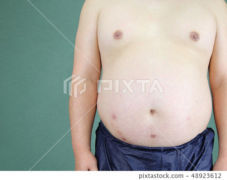 Metabolic middle-aged male upper body Metabolic middle-aged male upper body 48923612