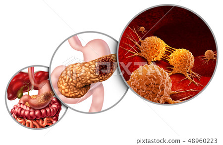 Pancreas Cancer Anatomy 48960223