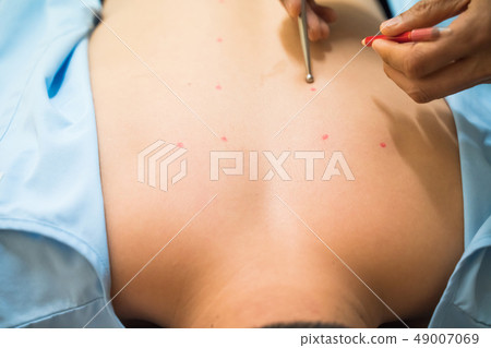 Acupuncture 49007069