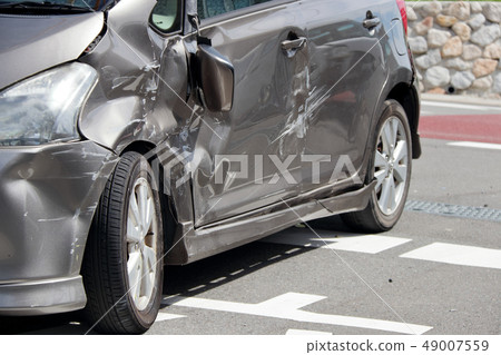 車禍傷口凹痕 車禍傷口凹痕 49007559