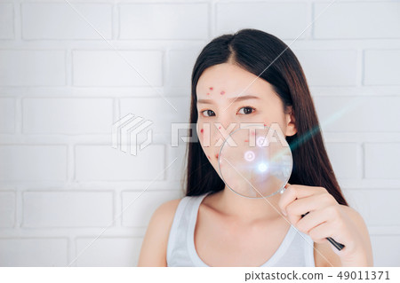 Asian woman with laser acne removal technology 49011371