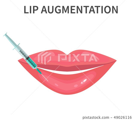 Lips injection Augmentation Lips injection Augmentation 49026116