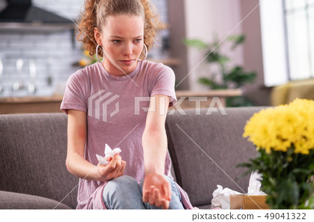 Unhappy curly-haired girl having spacious rash all over her body Unhappy curly-haired girl having spacious rash all over her body 49041322