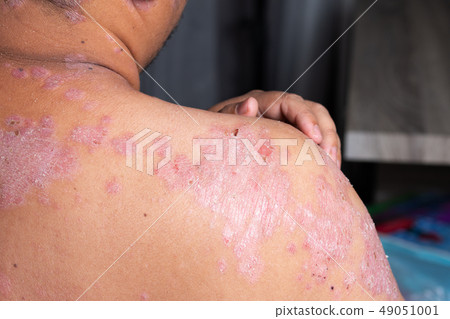 Men are using his hands to scratch the shoulder 49051001