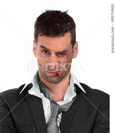 Close up of a businessman with bloody lip, beaten 49074909