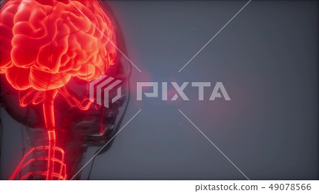 Human Brain Radiology Exam Human Brain Radiology Exam 49078566