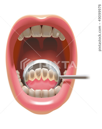 The back of the front teeth is dirty The back of the front teeth is dirty 49099976