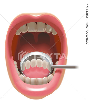 Look behind the front teeth with dental mirror Look behind the front teeth with dental mirror 49099977