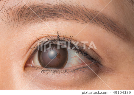 Eyes-up and Karakon young woman colored contact lenses and mascara 49104389