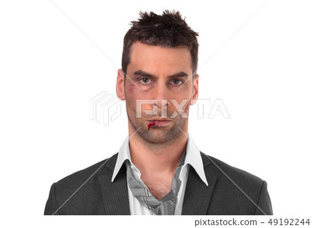 Close up of a businessman with bloody lip, beaten Close up of a businessman with bloody lip, beaten 49192244