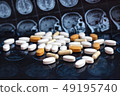 Pills on brain mri scan 49195740