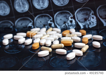 Pills on brain mri scan Pills on brain mri scan 49195740