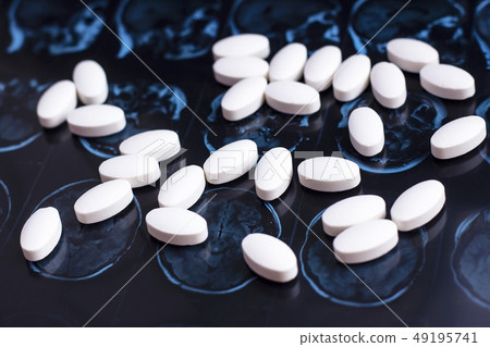 Pills on brain mri scan Pills on brain mri scan 49195741