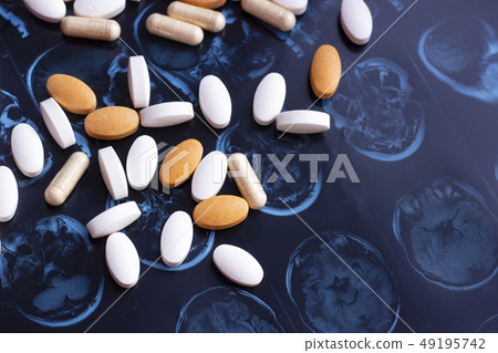 Pills on brain mri scan Pills on brain mri scan 49195742