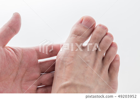 Male foot gout 49203952