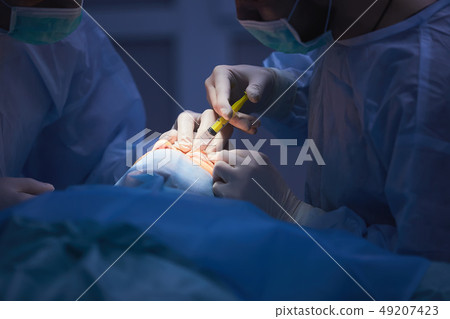 Plastic surgery of the eyelid in operating room, blepharoplasty. 49207423