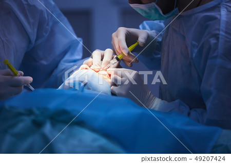 Medical Team Performing Surgical Operation in Modern Operating Room 49207424