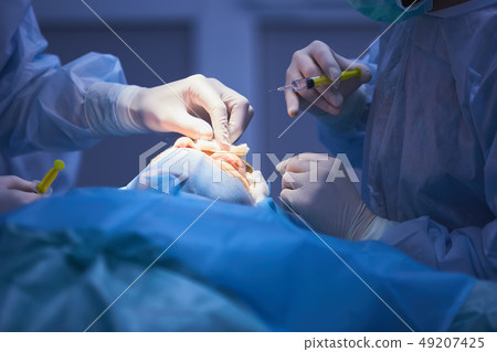 Plastic surgery of the eyelid in operating room, blepharoplasty. 49207425