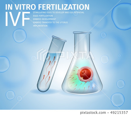 Union of Human Egg and Sperm Inside of Beaker. 49215357