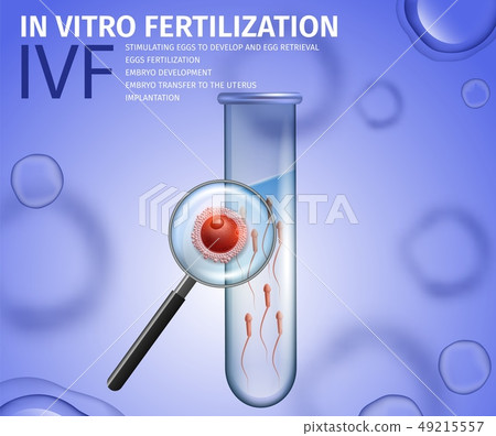 Close Up View Into Test Tube with Sperm and Egg 49215557