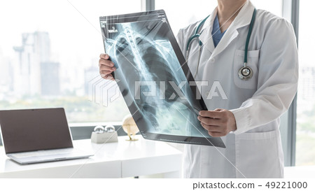 Doctor with radiological chest x-ray film patient 49221000