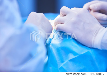 Medical team of surgeons in hospital doing minimal invasive surgical interventions. Surgery Medical team of surgeons in hospital doing minimal invasive surgical interventions. Surgery 49248817