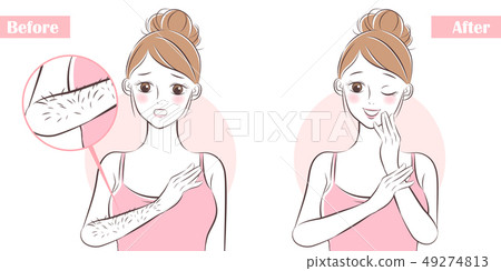 woman about hair removal 49274813