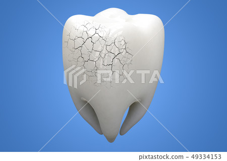 Illness Tooth on blue background. 3d illustration 49334153