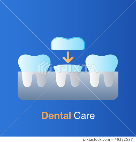 Dental care concept. Implant dentistry, Dental care concept. Implant dentistry, 49382587