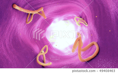 Tapeworm infestation in a human intestine 49408463