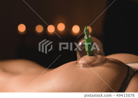 Close-up of wet caps for vacuum massage installed on the buttock of a young girl on the background Close-up of wet caps for vacuum massage installed on the buttock of a young girl on the background 49413876