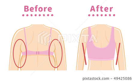Hami meat correction underwear under the side Hami meat correction underwear under the side 49425086
