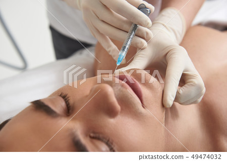 Man having rejuvenate procedure of smile lines Man having rejuvenate procedure of smile lines 49474032