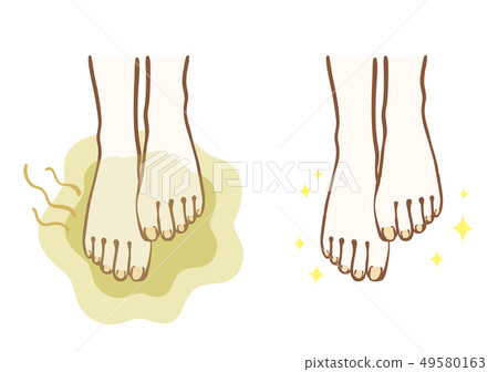 Foot odor before / after 49580163