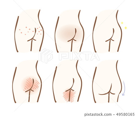Butt skin trouble set Butt skin trouble set 49580165